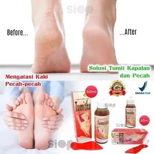 Tumitku Perawatan Kaki Pecah Pecah
