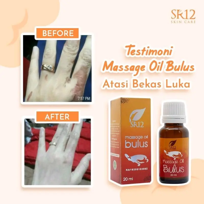 Minyak Bulus SR12 Aroma Melati Massage Oil Bulus SR12 Penghilang Stretchmark 5