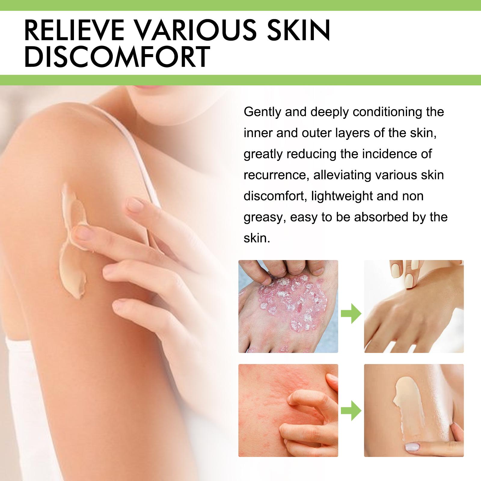 GATAL & KURAP LENYAP! South Moon Salep Rp69rb