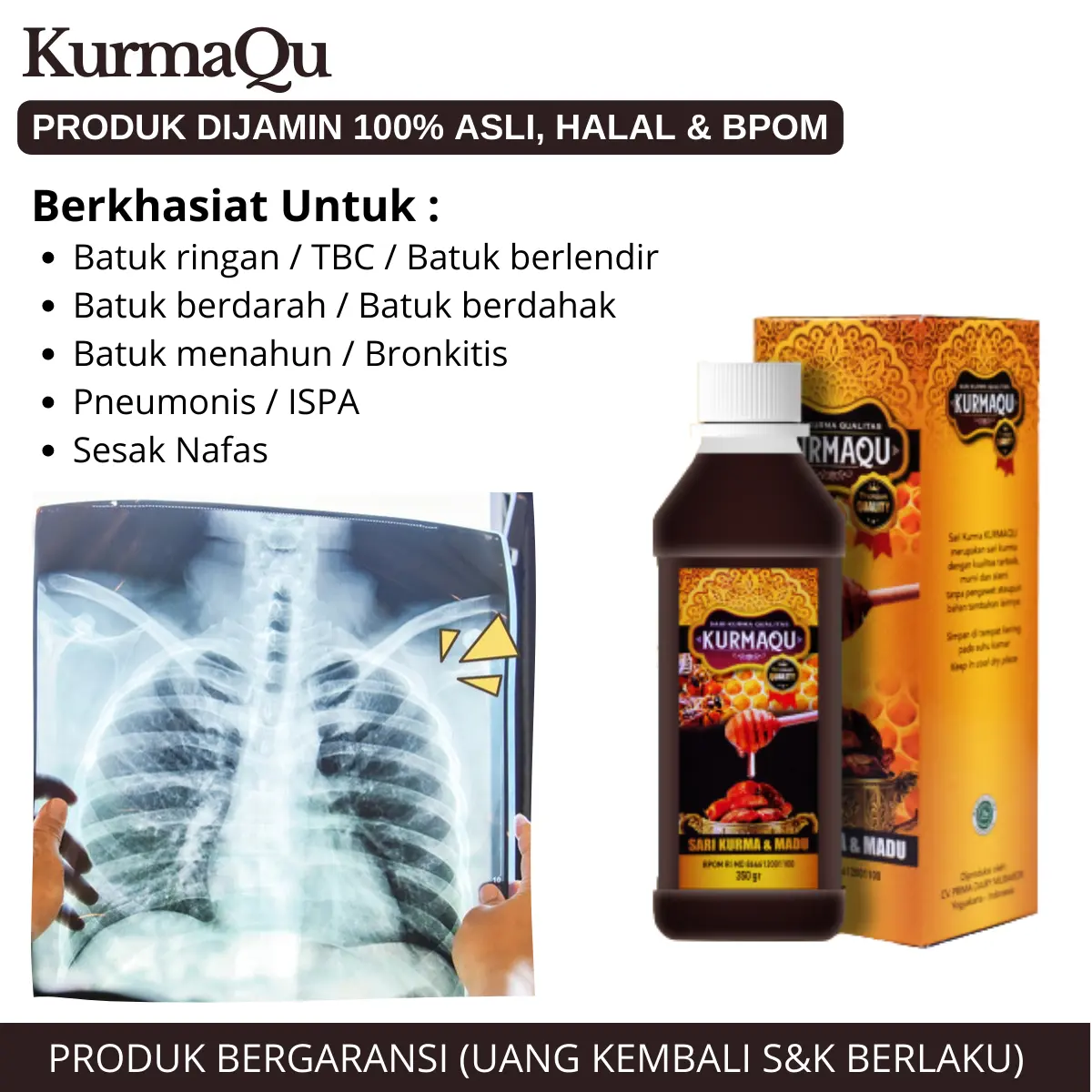 KurmaQu Untuk Flek Paru, Bercak Di Paru Penyakit Tuberkulosis Atau Tbc Untuk Anak Dan Dewasa