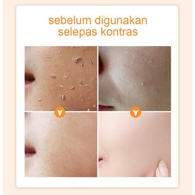Product Introduction of 『BUY 1 TAKE 1』SUNISA Underarm Whitening Cream with Exfoliating Gel Skin Care Set 30g+100g Suitable for All Skin Types 35