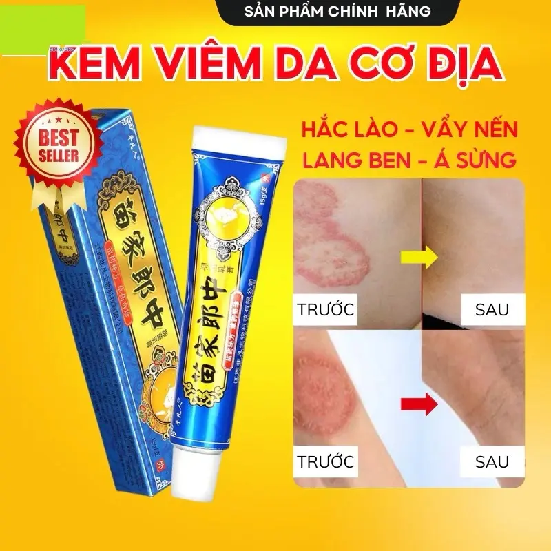 [ LOẠI 1 ] Kem Bôi Viêm Da Cơ Địa Dứt Điểm Lác Đồng Tiền, Hắc Lào, Á Sừng, Côn Trùng Đốt Hiệu Quả - BÀ LÃO XANH
