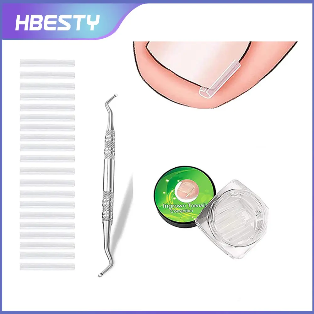 Nẹp Rãnh Móng Tay Loại C, Miếng Đệm Móng Tay Nhú Cách Ly, Dụng Cụ Đệm Định Hình Làm Đầy Viêm Móng Tay, Thích Hợp Để Khắc Phục