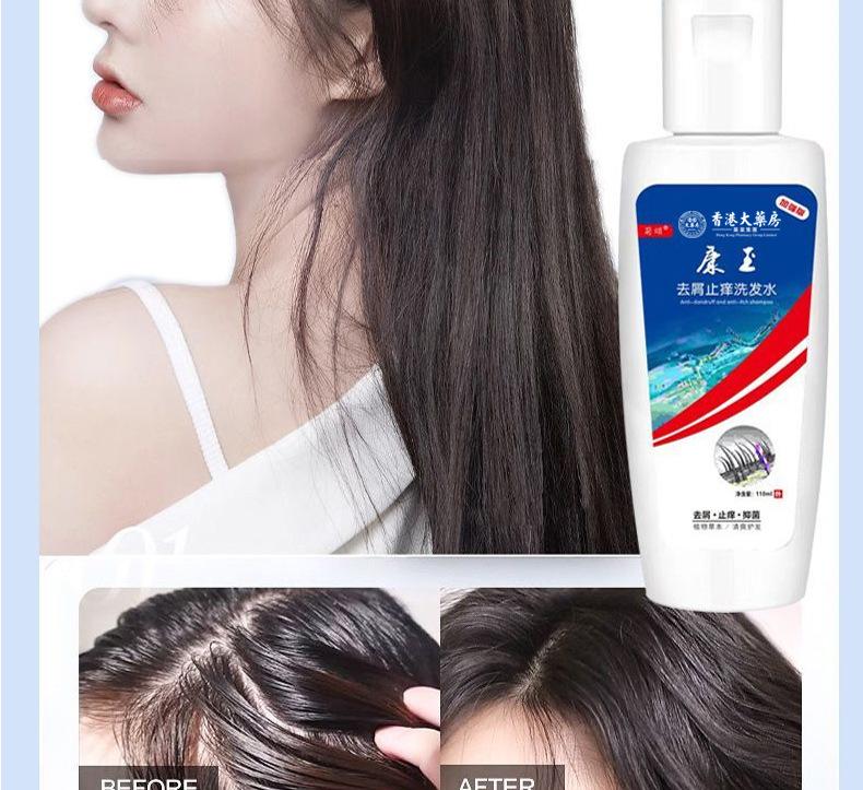 Product Introduction of Xikangwang Anti-Dandruf and Relieve Itching Washing Water Oil Removing Refreshing Skin Washing Cream Anti-Mite Grease-Overflow Moss Lotion 12