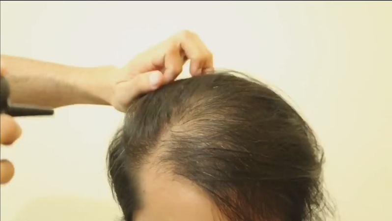 Product Introduction of เซ็ตคู่ ผงไฟเบอร์สีดำ+หัวพ่น พร้อมใช้ได้ง่าย สะดวก ปิดผมบาง 6