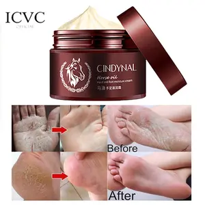 TERAMPUH!! Krim Herbal China Menghaluskan Melembutkan Salep Kaki Pecah Kering Ampuh Tangan Kapalan Kasar CINDYNAL Horse Oil Mengencangkan