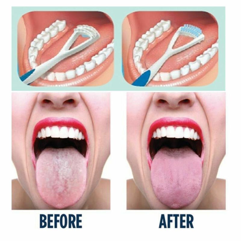 x3 Tongue Scrapers Dental Mouth Cleaner Hygiene Oral Brush Tool Bad Breath Teeth 4