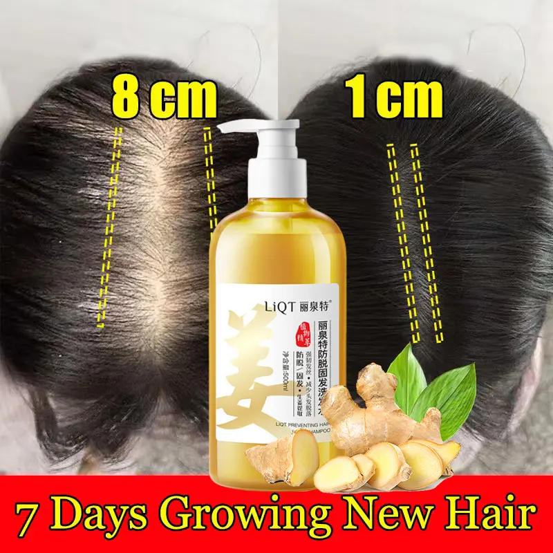 LiQT Hair loss shampoo shampoo oily scalp Hair growth shampoo Ginger shampoo 500ml ginger plant extract Anti hair loss Fast hair growth Anti dandruff Control oil Relieve itching