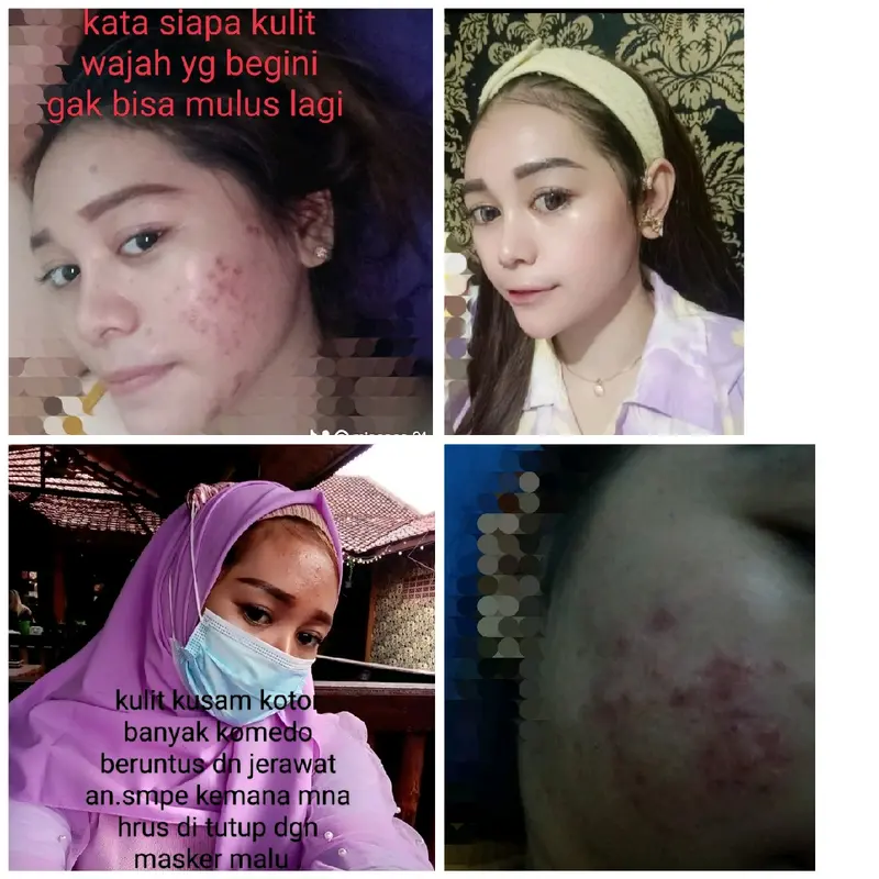 paket whitening kulit sensitif 4