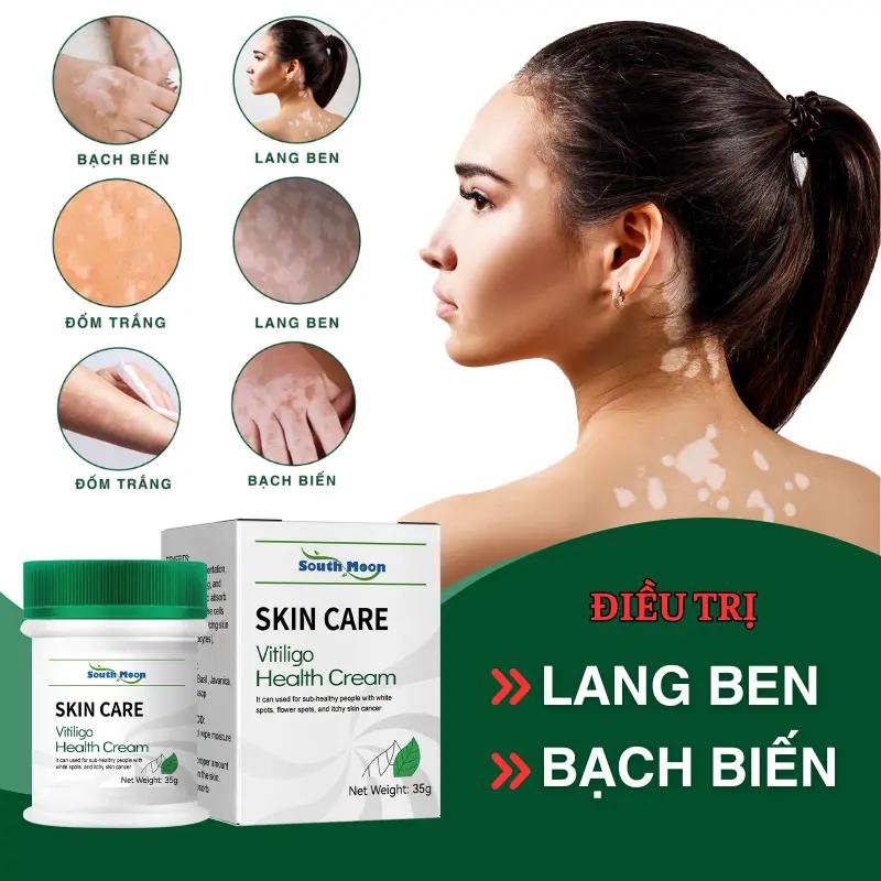 Kem Bôi Thảo Dược SOUTH MOON 35g Hỗ Trợ Điều Trị Lang Ben, Bạch Biến, Hắc Lào