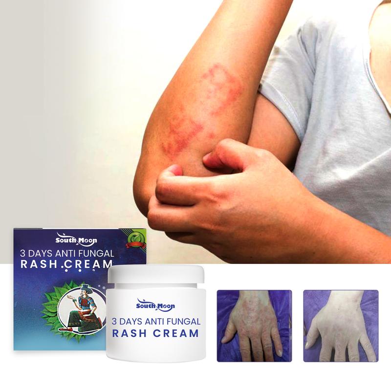 South Moon 3 Days Aati Fungal Rash Cream, Repair Skin Barrie - TikTok Shop