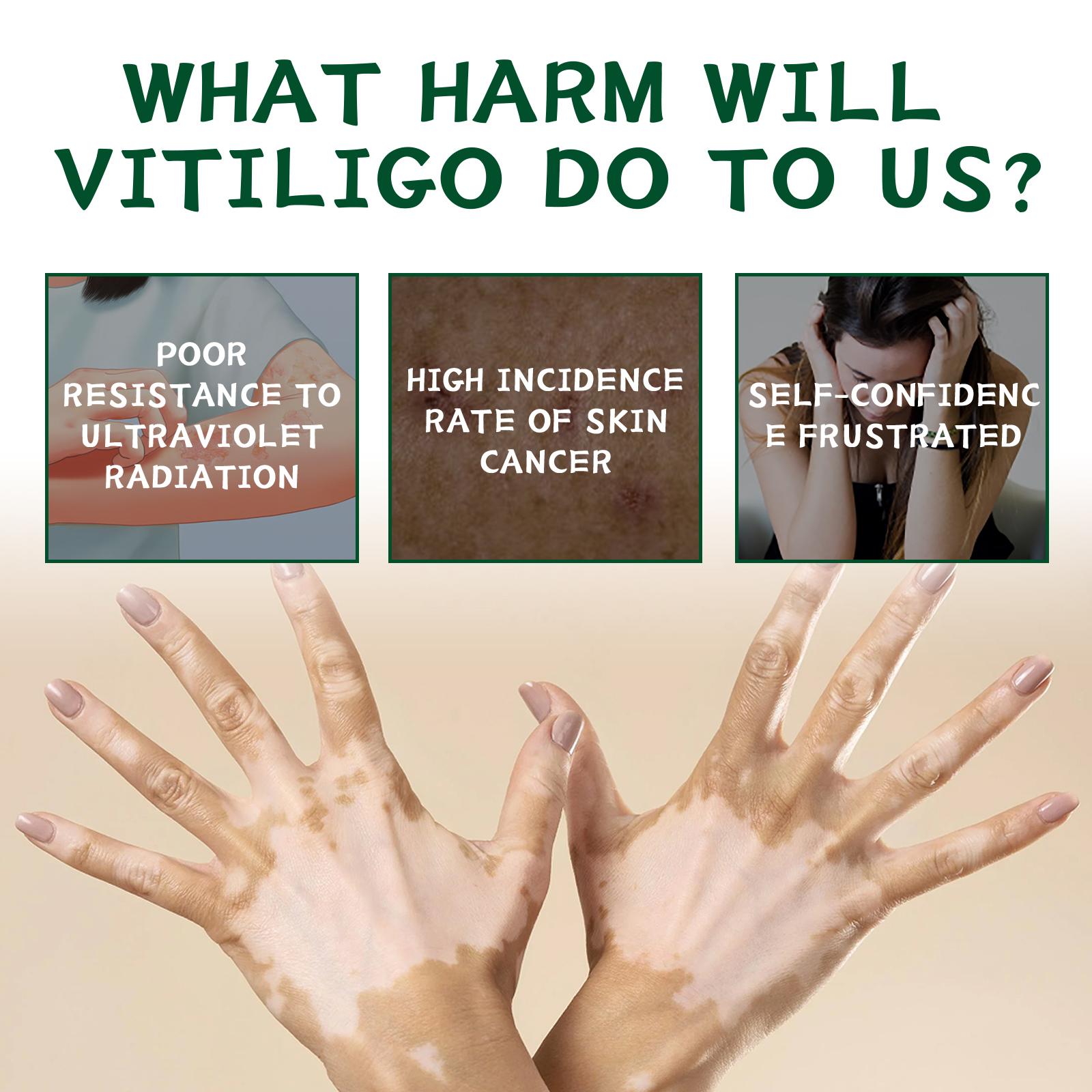 Pengiriman Cepat Prioritas Pengiriman Krim Perawatan Kulit South Moon Krim Perawatan Eksternal untuk Membersihkan, Melembapkan, dan Memperbaiki Kulit Tubuh Mengurangi Ketidaknyamanan