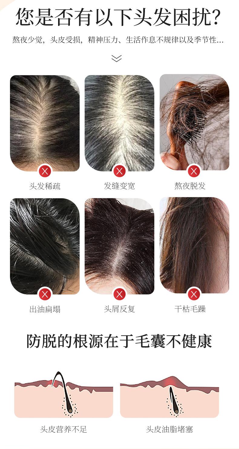 Product Introduction of Anti-hair removal shampoo hair care hair fixation hair repair anti-dandrucleansing and oil controlling shampoo 1