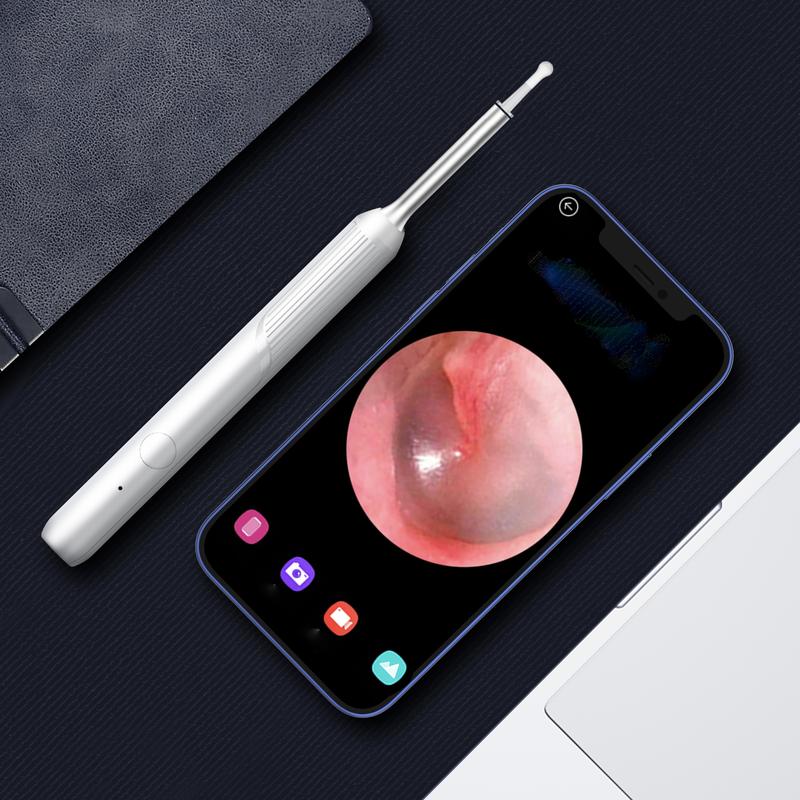 Ear Wax Cleaner  Smart Visual Removal Kit HD Camera FygoDreamer  Gift for her him Christmas gift 2