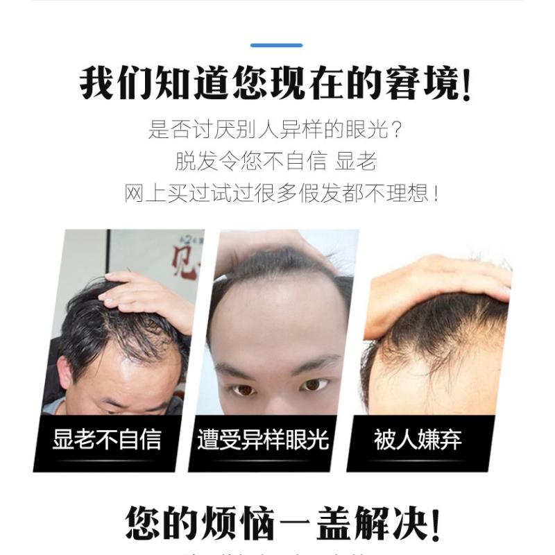Product Introduction of Hairline Wig Men's Wig Patch Forehead Replacement Piece Real Hair Full Hand-woven Biological Scalp Bangs 19