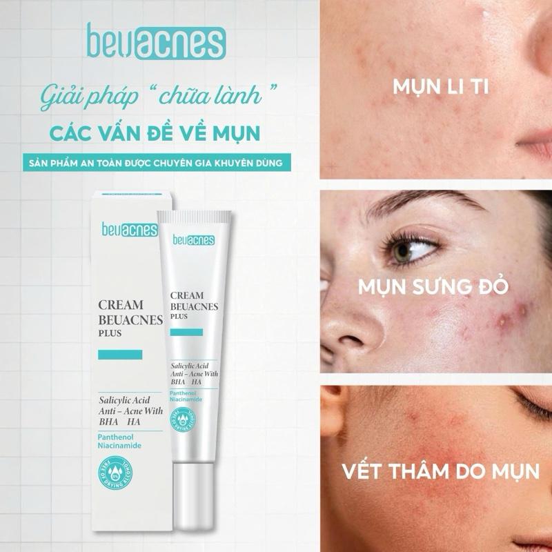 Kem Mụn BEUACNES PLUS - 15g - Hỗ Trợ Giảm Mụn, Sáng Da, Mờ Thâm Mụn, Dưỡng Ẩm Da, Giải Pháp An Toàn Cho Làn Da Mụn, Skincare Chăm Sóc Da Dưỡng Ẩm Da Làm Đẹp Da Nữ Women - TM61 chấm mụn