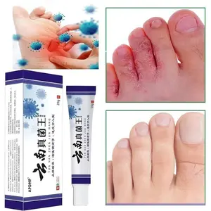 COD Obat Kaki Rayapan 20g Dan Bau Penghilang Bau Kaki Obat Jamur Kaki Obat Kaki Jamuran Pembersih Kulit Mati Kaki Obat Kaki Bolong Salep Gatal Kaki Paling Ampuh Krim Antibakteri Tinea Pedis