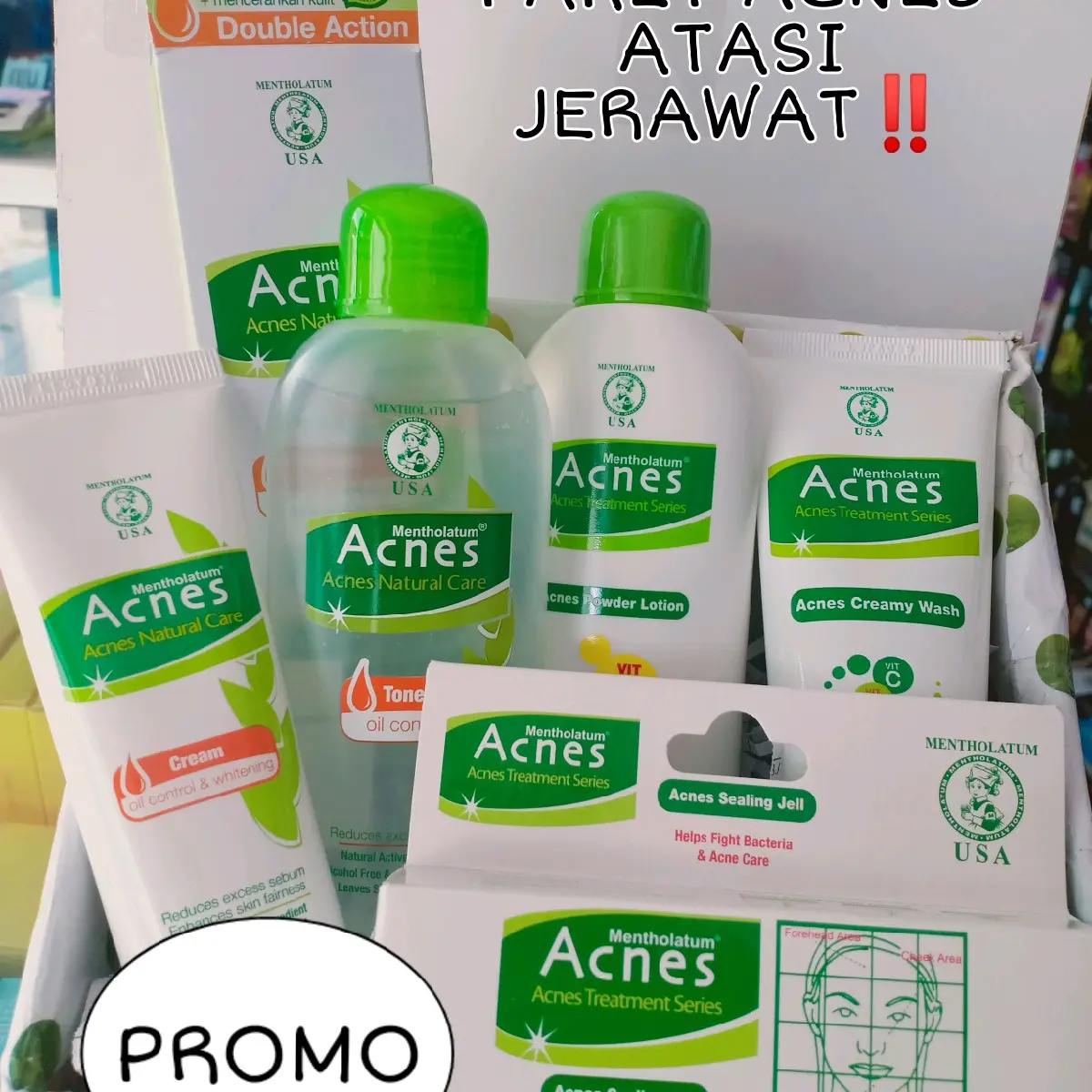 Paket Acnes Berjerawat Kering Wajah Facial