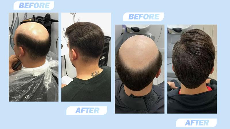 Product Introduction of K.S WIGS Fine Mono Human Hair Wig Men Toupee 120% Density Natural Wig Hair System Human Hair Toupee 1B# for Men Male Wig Hair 11