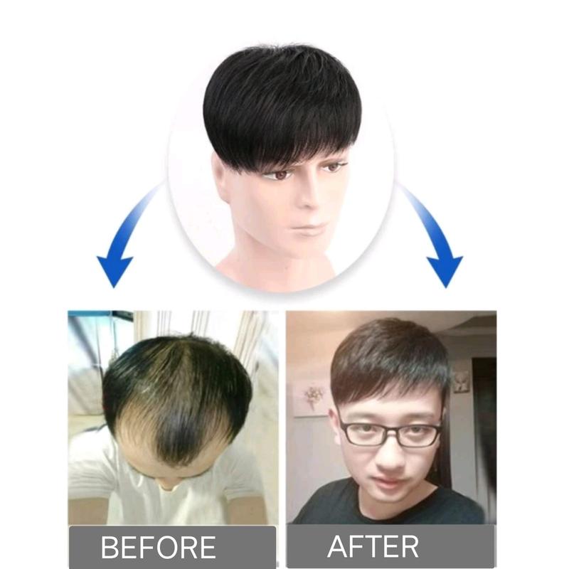 COD-Toupee Pria Rambut Pendek Warna Hitam Penutup Botak Pria Rambut Pendek Hitam Natural 2