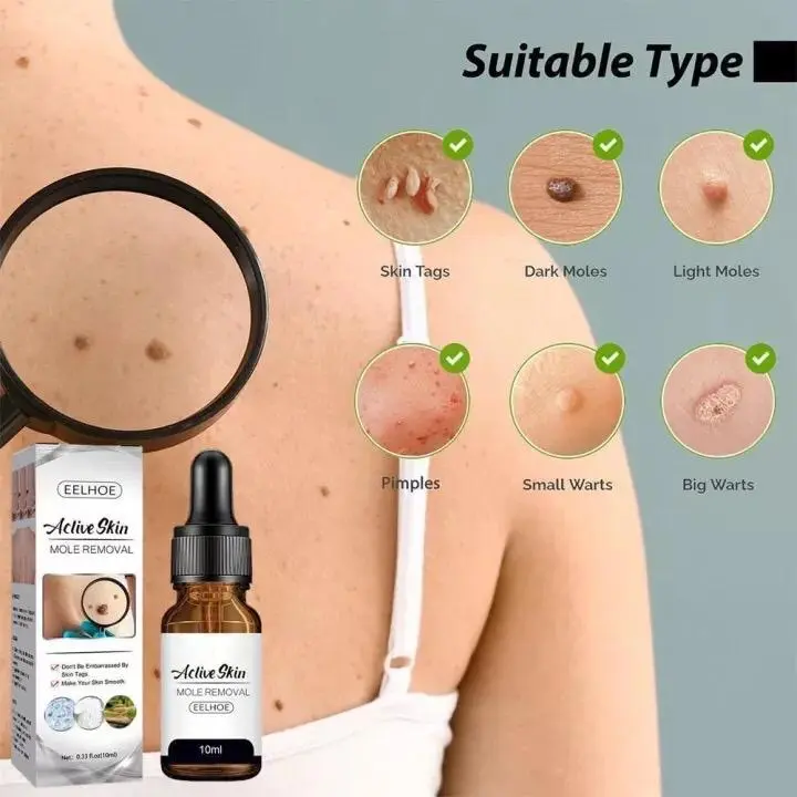Eelhoe Aclive Skin Mole Removal, Serum Penghilang Tahi Lalat Dan Kutil Isi 10ml Perawatan Essence Cairan 2
