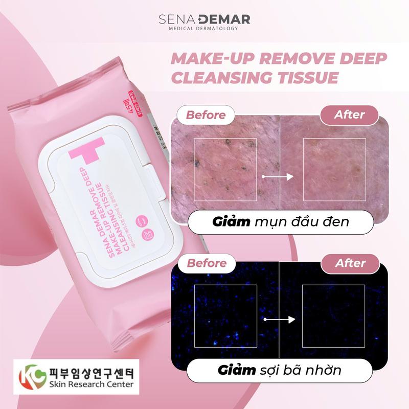 [ SenaDemar] Khăn Tẩy Trang SenaDema Thuần Chay, Sạch Sâu, Cân Bằng Độ pH, Hỗ Trợ Làm Ẩm Da, Hỗ Trợ Giảm Mụn Đầu Đen, Sợi Bã Nhờn.  [ 45miếng/Túi] 4