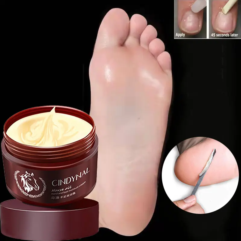 Kem Dầu Ngựa, CINDYNAL, Kem Dưỡng Da Tay Và Chân Chính Hãng, 110g, Kem Chống Nứt Nẻ, Dưỡng Ẩm, Làm Trắng, Phục Hồi Da Chà Vảy, Làm Sáng, Làm Mịn, Kem Dưỡng Ẩm, Thích Hợp Cho Mặt, Tay Và Bàn Chân, Có Thể Được Sử Dụng Cho Da Thô Và Khô Và Nứt Nẻ