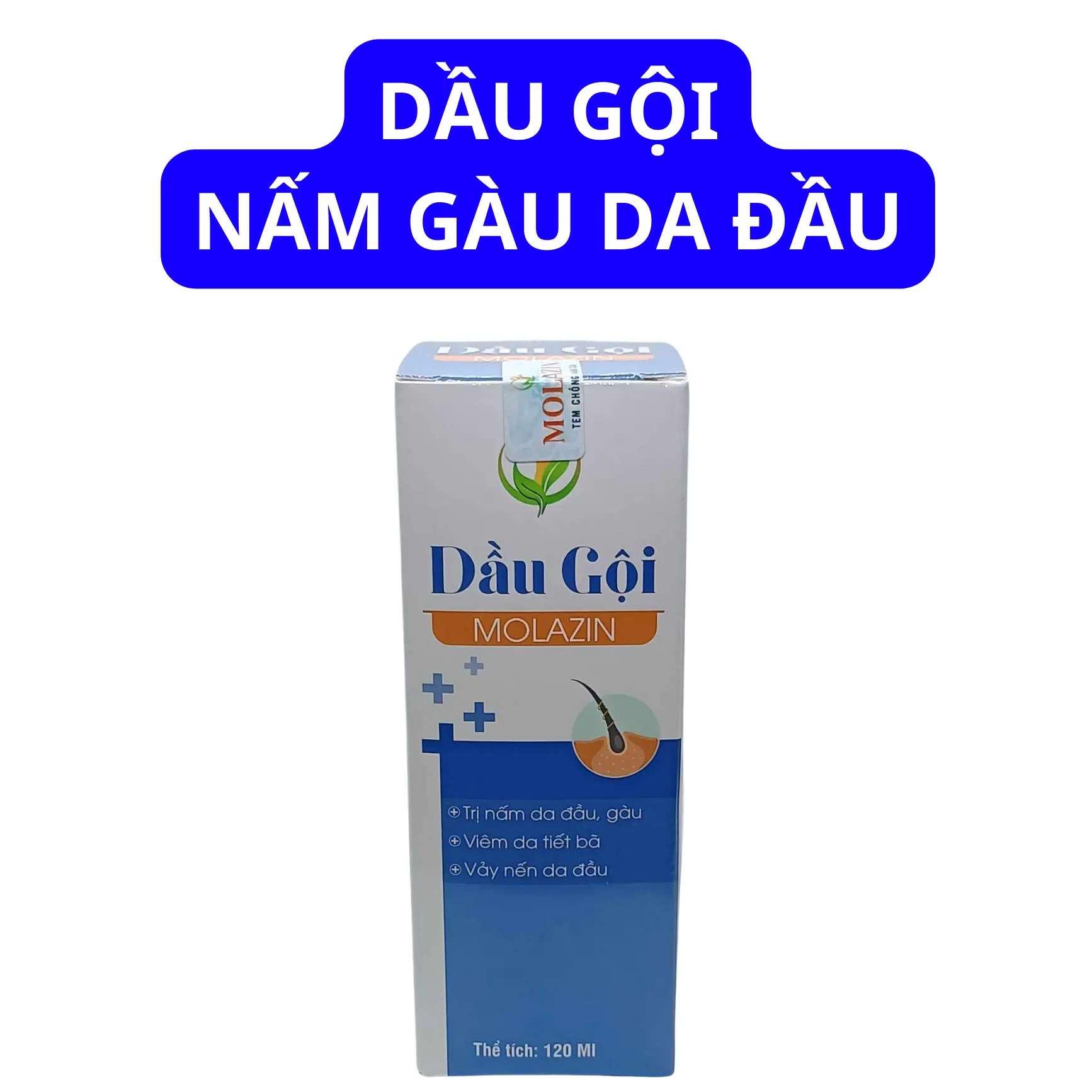 Dầu Gội Cho Người Bị Nấm Da Đầu, Gàu Da Đầu,  Ngứa - Hãy Để Molazin Chữa Dứt