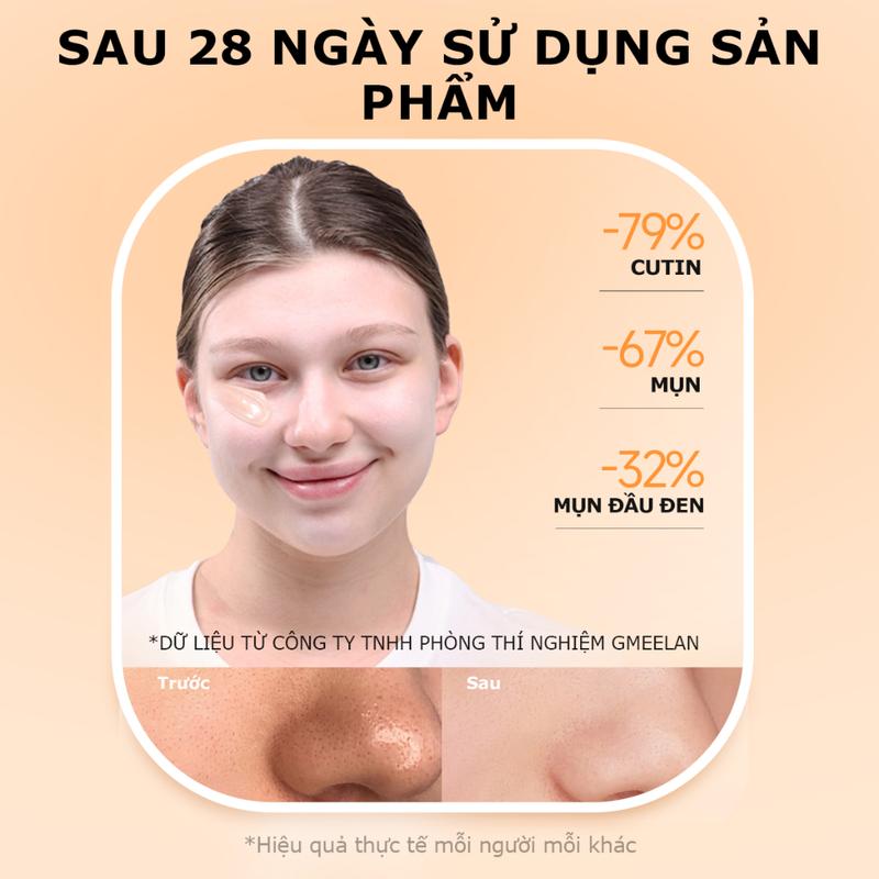 Gel Tẩy Tế Bào Chết Mặt GMEELAN 50g - Làm Sạch và Tẩy Da Chết Cho Da Dầu Mụn 1