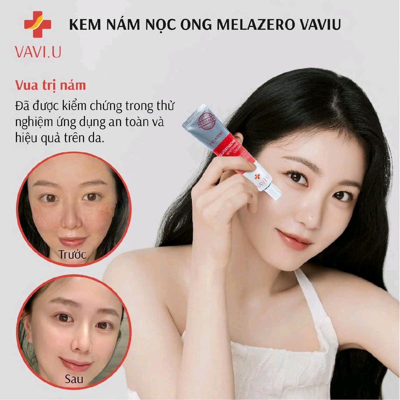 kem nám nọc ong Melazero vaviu 8