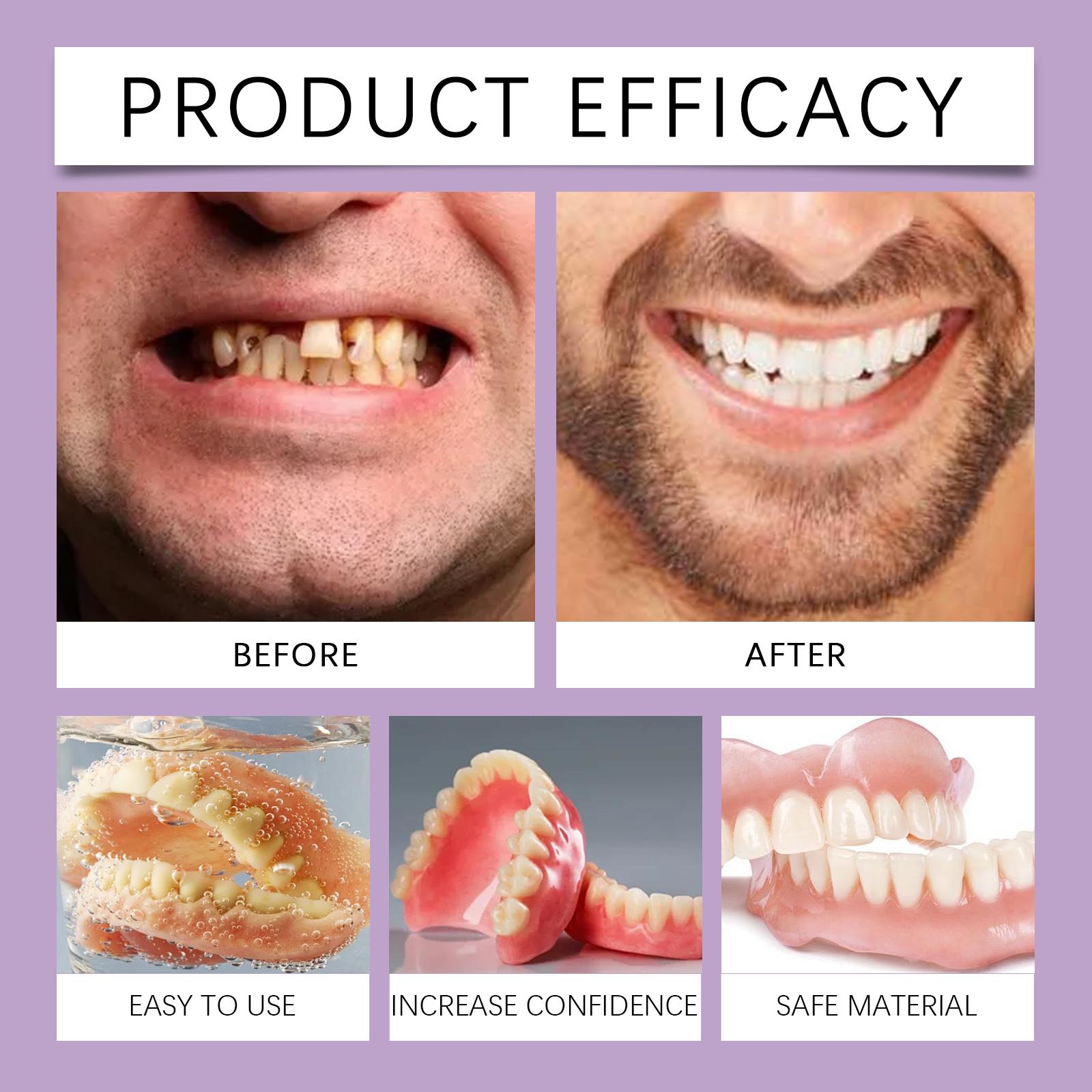 Penjualan panas Satu set yang menggabungkan kenyamanan dan kecocokan, dengan berani mengunyah makanan keras - Aksesori gigi Oralhoe, dibuat dengan bahan nyaman untuk meningkatkan estetika senyum, adalah alat kecantikan gigi yang nyaman untuk perawatan gig