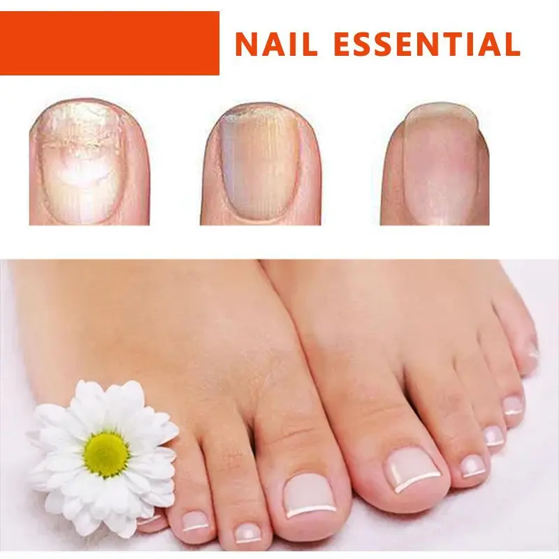 Tinh Dầu Chăm Sóc Móng, Hoa Oải Hương, 10ml, H9Q1, Để Chăm Sóc Móng 5