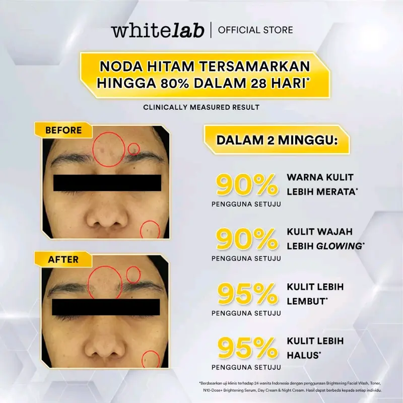 Whitelab Brightening Toner Acne Toner 100ml / Face Toner Pembersih Wajah Kusam 4