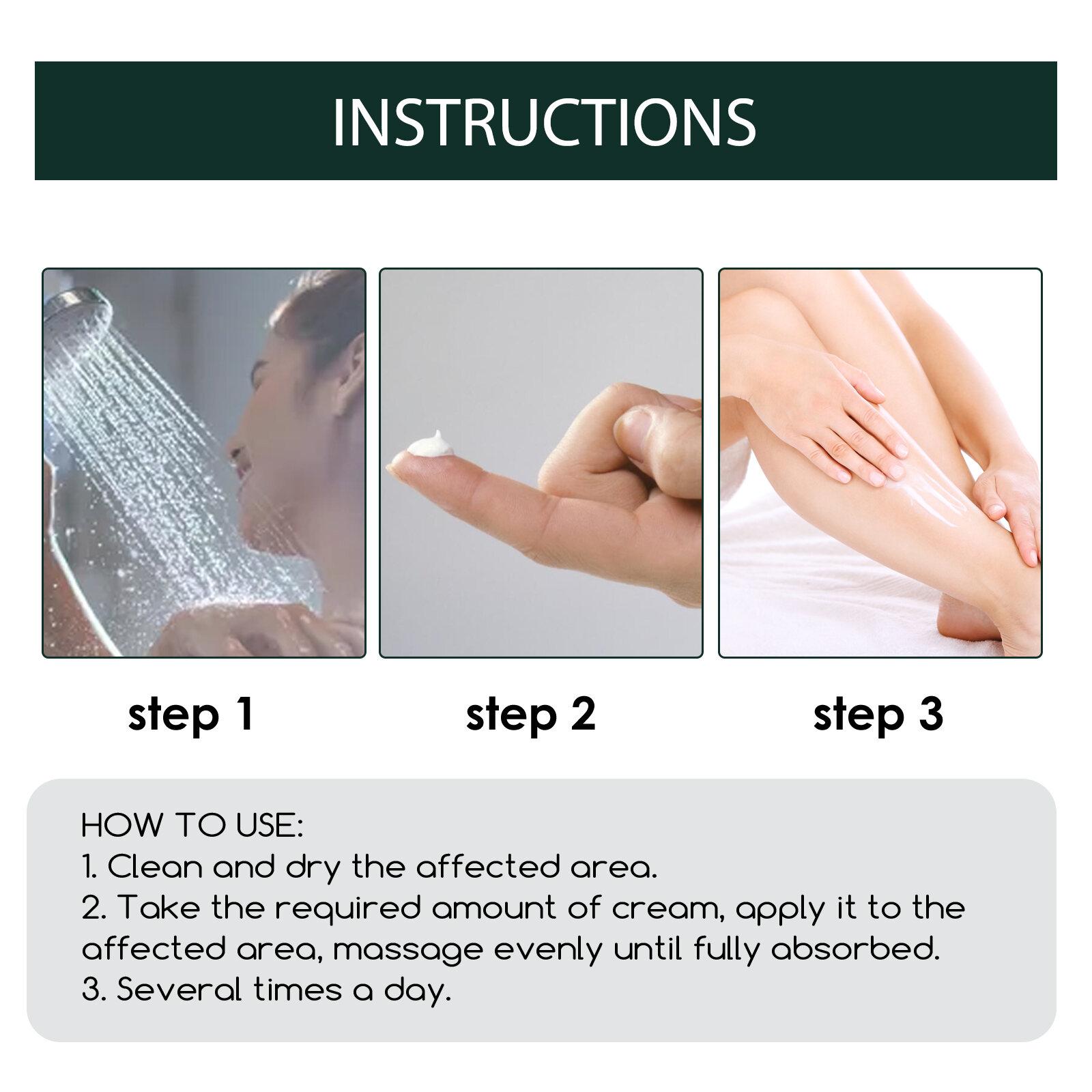 Salep Psoriasis Anti-Gatal South Moon Krim Perbaikan Psoriasis meredakan gatal Perbaikan Kulit