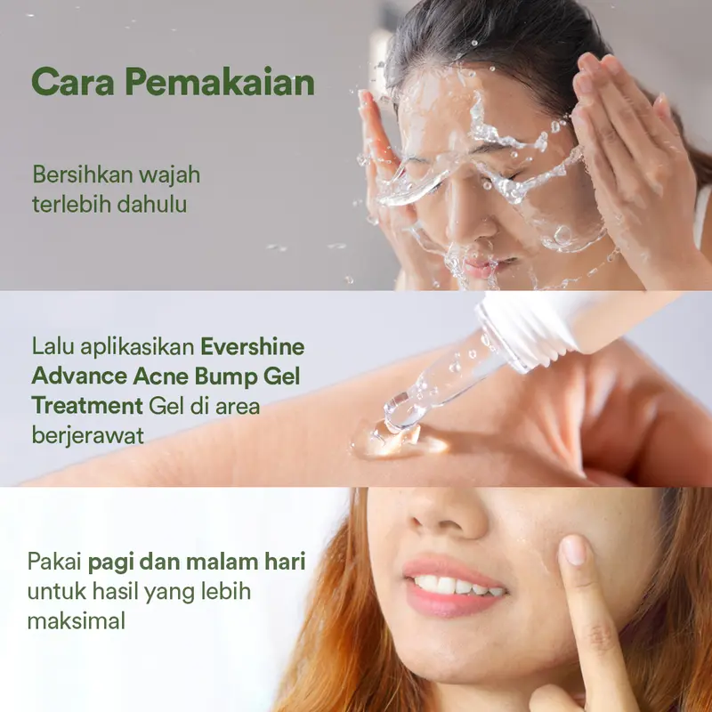 Evershine Advanced Acne Bump Treatment Gel 4