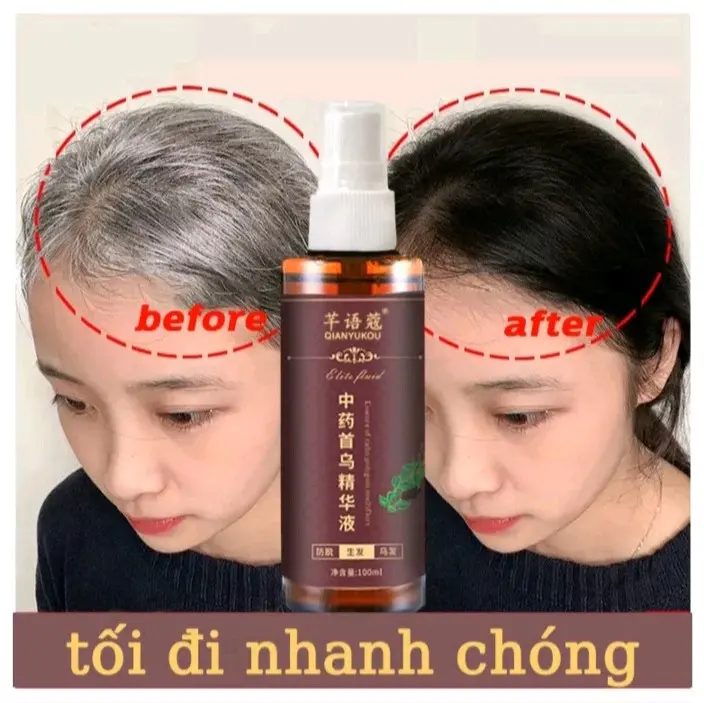 CHAI XỊT TÓC ĐEN TÓC TRẮNG BIẾN THÀNH TÓC ĐEN CỰC NHANH LOẠI TỐT