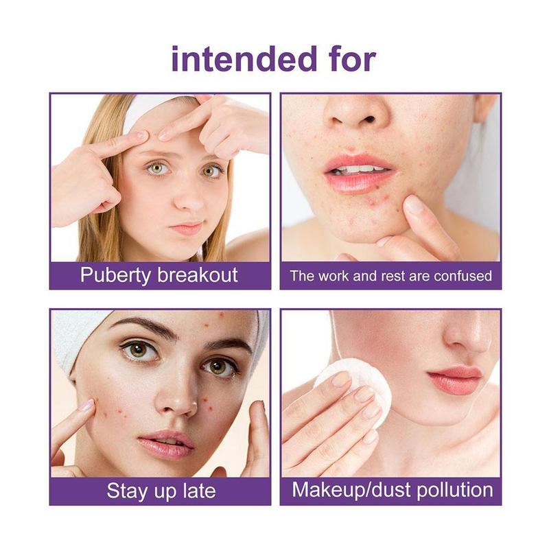 180pcs/box Hydrocolloid Acne Patch Pimple Repair Patch Ance Colorful Starry Care Face Sky L7K7 7